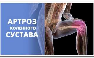 Болят суставы? Попробуйте препарат Дона!