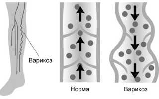 УЗИ сосудов: цели и виды